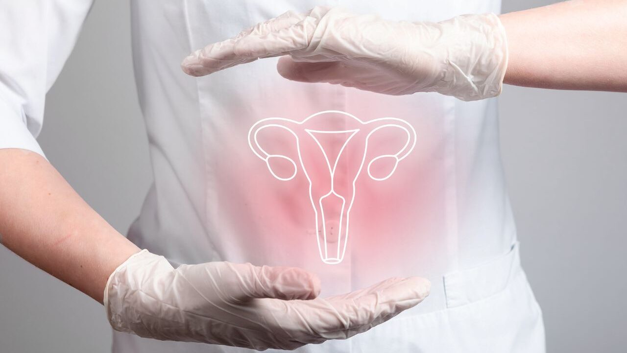 endometriosis