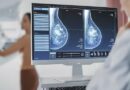 Realizan mamografías gratuitas en clínica San Miguel